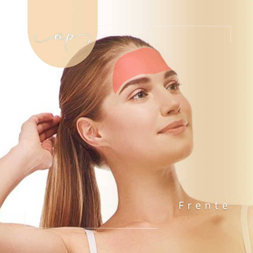 Frente | Depilación Láser