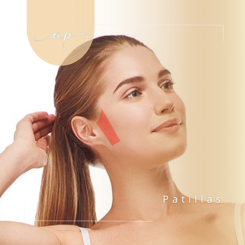 Patillas | Depilación Láser