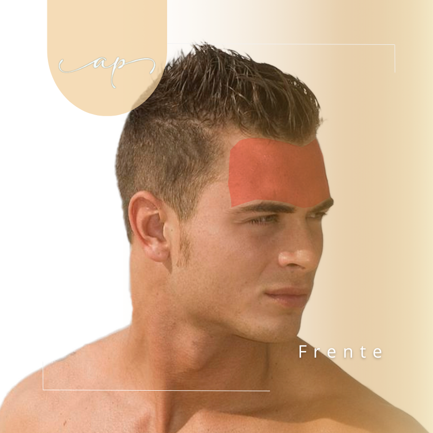 Frente hombre
