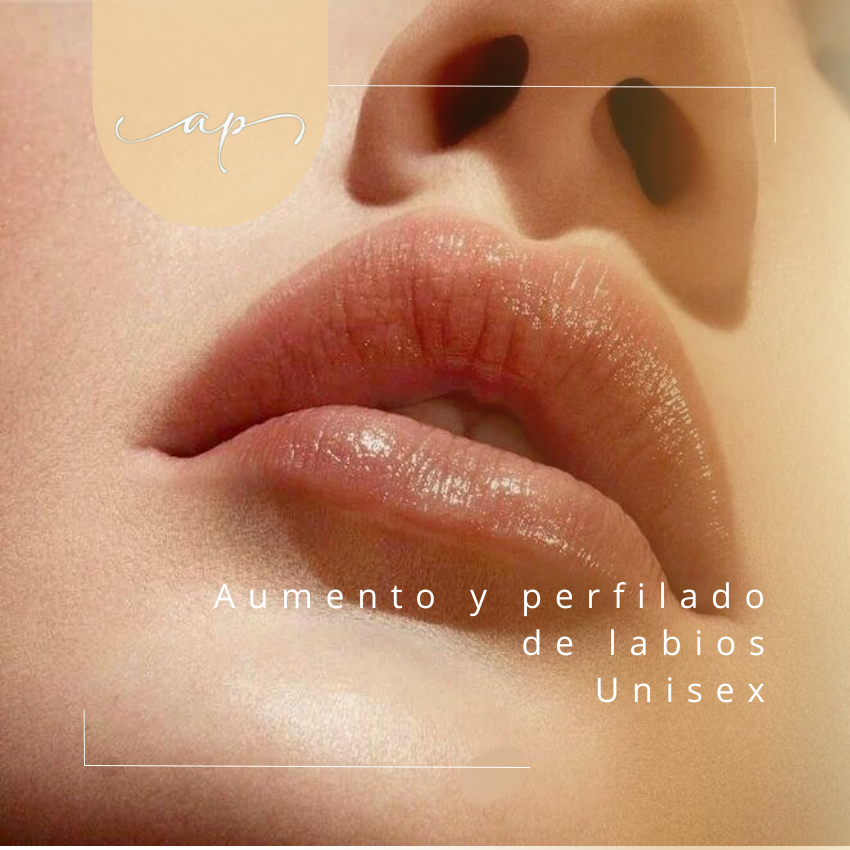 Aumento y perfilado de labios