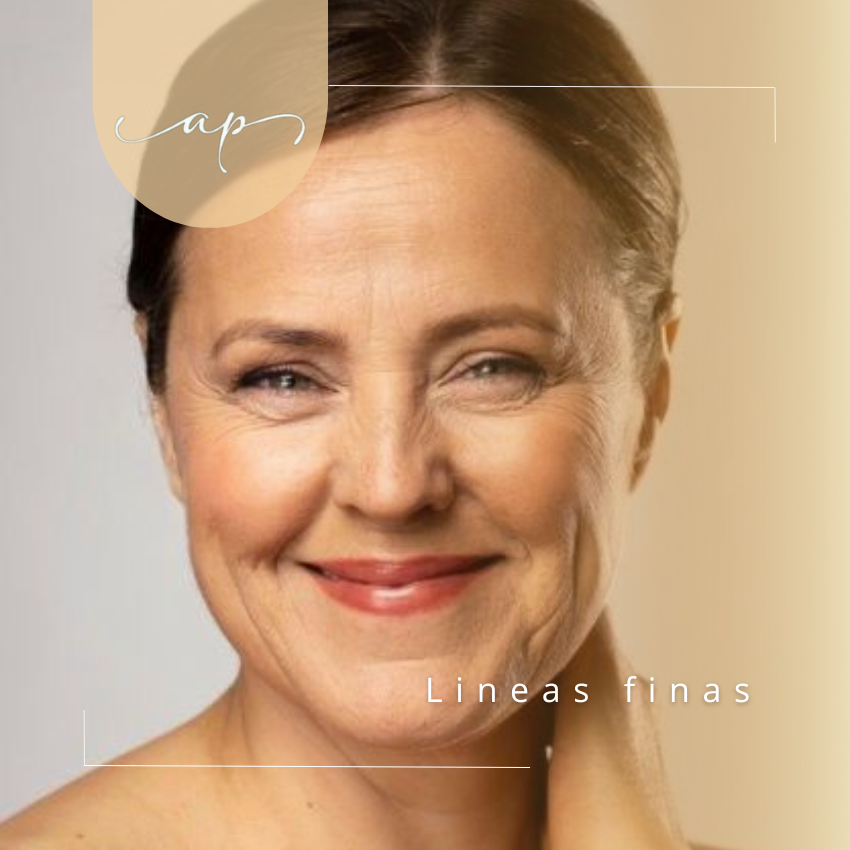 Líneas finas y arrugas