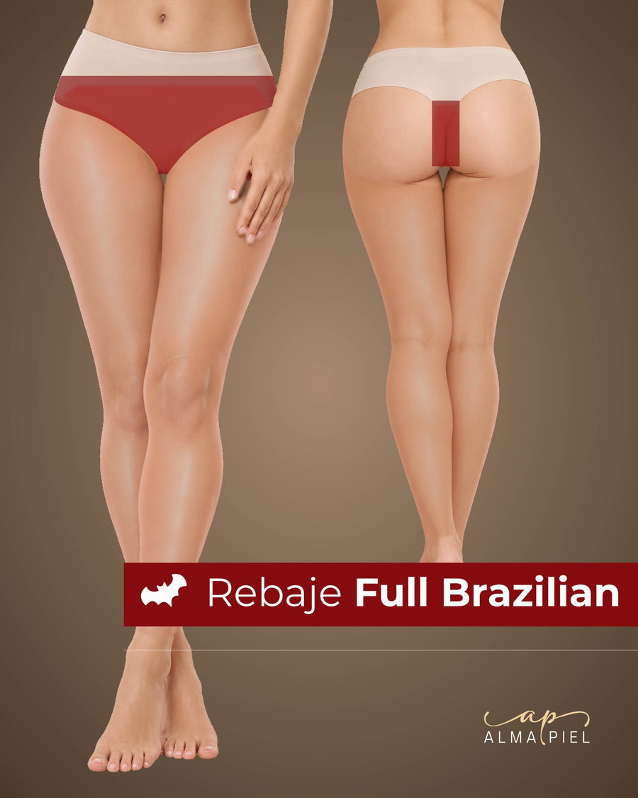 Depilación láser Rebaje Full Brazilian