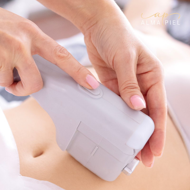 HIFU Abdomen + Flancos