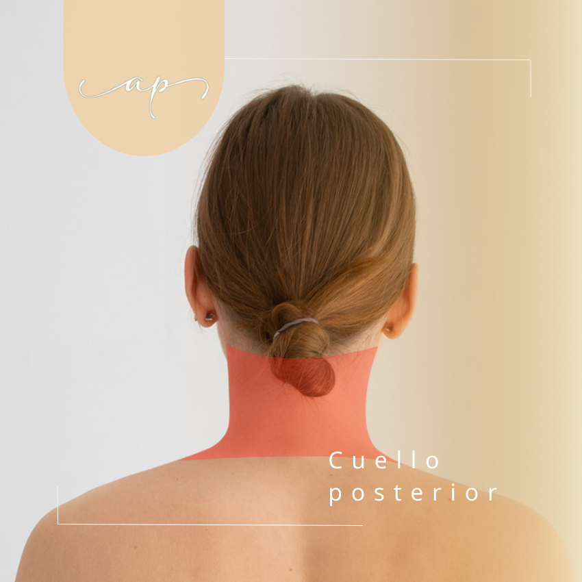 Cuello posterior | Depilación Láser