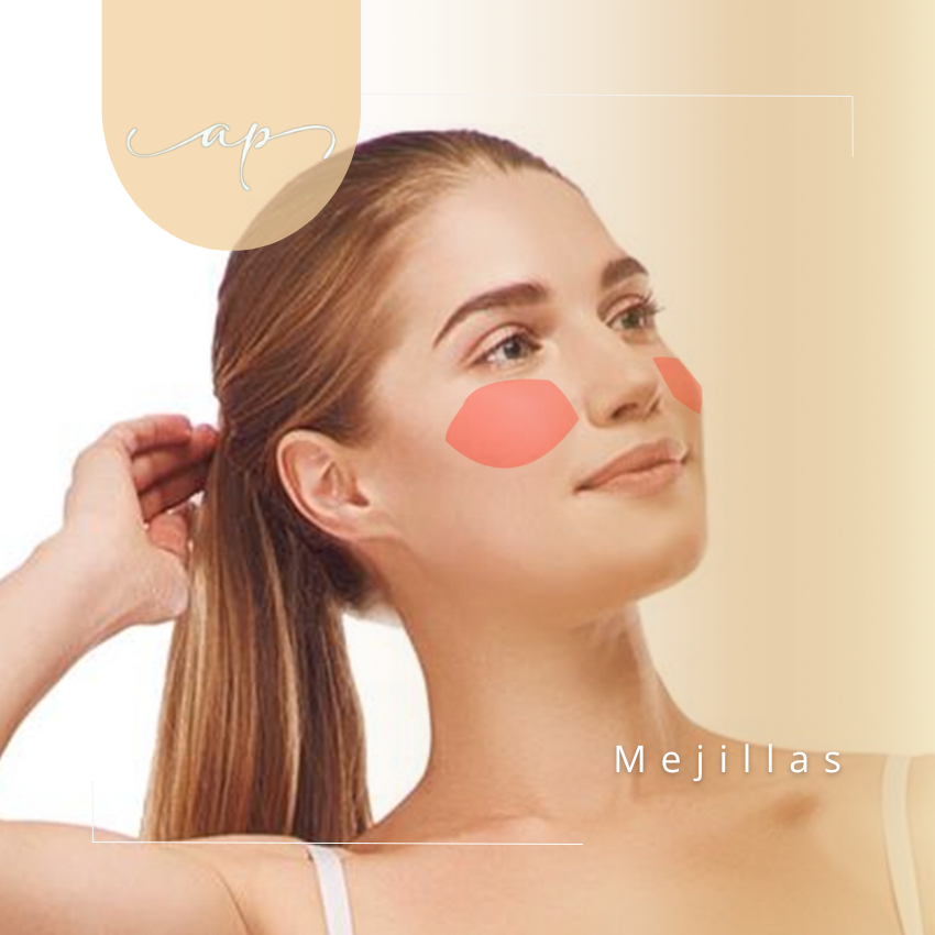 Mejillas | Depilación Láser