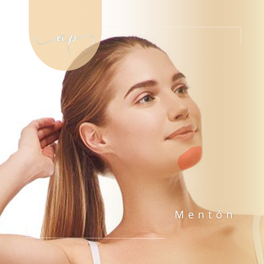 Mentón | Depilación Láser