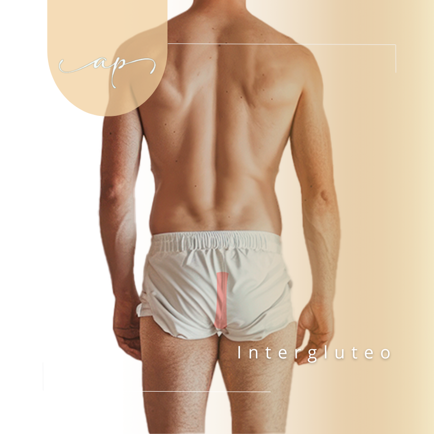 Interglúteos hombre